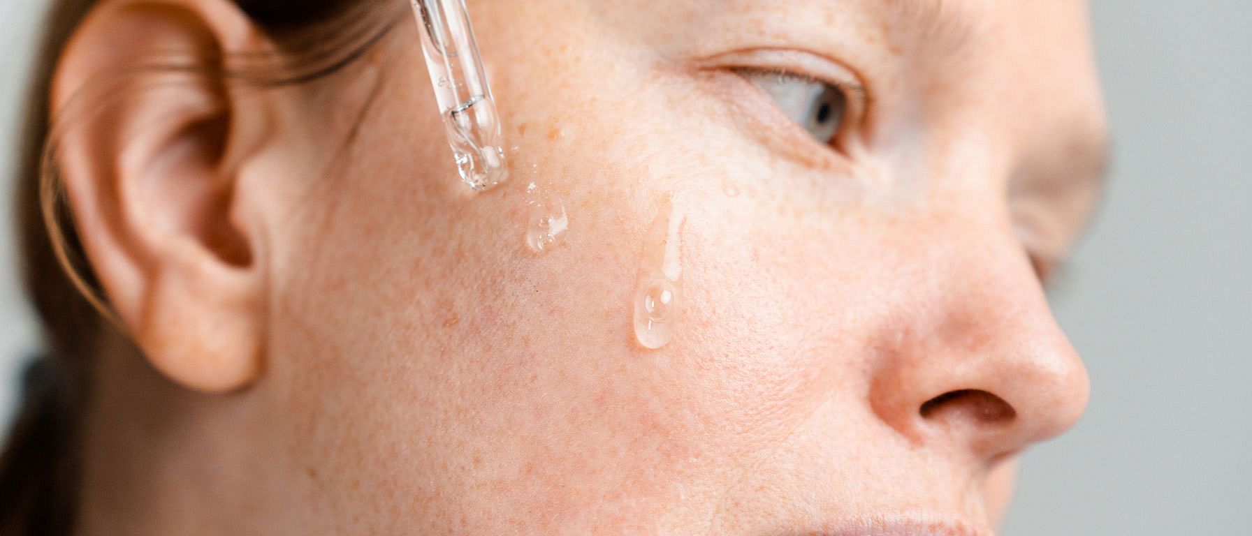 Frau Pigmentflecken Pipette Serum
